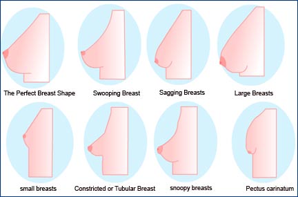 breast and chest wall shapes